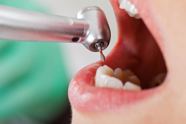 Best Weekend Emergency Dentist in Morada, CA